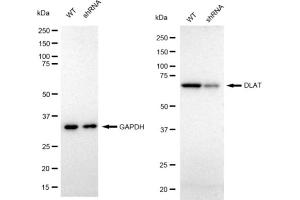 Western blotting analysis using DLAT antibody (ABIN7798336).
