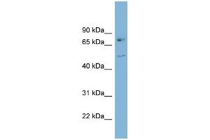 WB Suggested Anti-AADAT Antibody Titration:  0. (AADAT anticorps  (Middle Region))