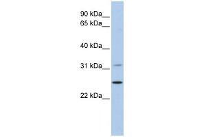 DHRS1 antibody used at 1 ug/ml to detect target protein. (DHRS1 anticorps)