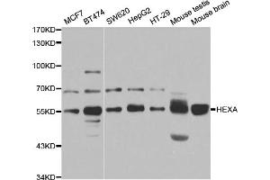 Western blot analysis of extracts of various cell lines, using HEXA antibody (ABIN5973292) at 1/1000 dilution. (Hexosaminidase A anticorps)