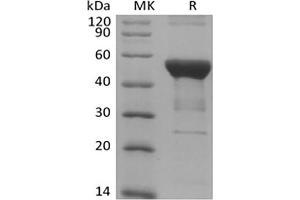 Western Blotting (WB) image for Nuclear Factor of kappa Light Polypeptide Gene Enhancer in B-Cells 1 (NFKB1) protein (His tag) (ABIN7319855) (NFKB1 Protein (His tag))