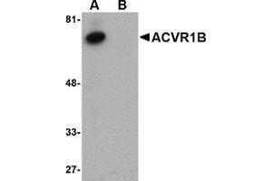 Western Blotting (WB) image for anti-Activin A Receptor, Type IB (ACVR1B) (C-Term) antibody (ABIN1030218) (Activin A Receptor Type IB/ALK-4 anticorps  (C-Term))