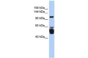 LRRC8B antibody used at 1 ug/ml to detect target protein. (LRRC8B anticorps  (N-Term))