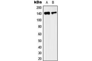 Western blot analysis of KIF4A expression in MCF7 (A), SP2/0 (B) whole cell lysates. (KIF4A anticorps  (C-Term))