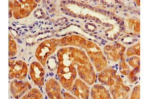 anti-ATG3 Autophagy Related 3 (ATG3) (AA 1-314) antibody