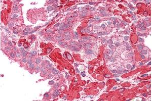 ABIN2613490 (2. (Tropomyosin 4 anticorps  (C-Term))