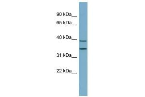 PRKAB1 antibody used at 1 ug/ml to detect target protein.
