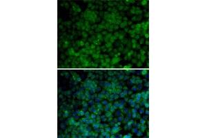Immunofluorescence analysis of HeLa cells using CDK7 antibody (ABIN3022404, ABIN3022405, ABIN3022406 and ABIN6218792).