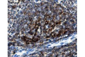IHC analysis of CD74 using anti-CD74 antibody (ABIN7603166). (CD74 anticorps  (N-Term))