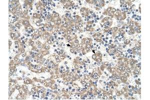 KYNU antibody was used for immunohistochemistry at a concentration of 4-8 ug/ml to stain Hepatocytes (arrows) in Human Liver. (KYNU anticorps)