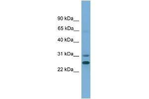 WB Suggested Anti-DHRS2 Antibody Titration:  0. (DHRS2 anticorps  (N-Term))