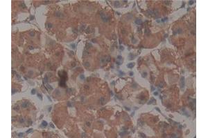 Detection of TEP1 in Human Stomach Tissue using Polyclonal Antibody to Telomerase protein component 1 (TEP1)