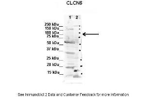 Lanes:   1. (CLCN6 anticorps  (C-Term))