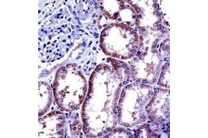 Immunohistochemistry analysis in formalin fixed and paraffin embedded human kidney tissue reacted with Interleukin-6 (IL6) Antibody (Center) followed by peroxidase conjugation of the secondary antibody and DAB staining. (IL-6 anticorps  (Middle Region))