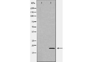 Western blot analysis of Rat spleen lysate, using LY96 Antibody. (LY96 anticorps  (Internal Region))