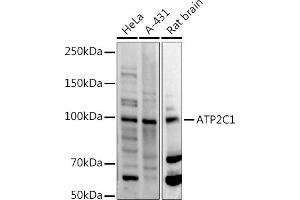 Western blot analysis of extracts of various cell lines, using C1 antibody (ABIN3016169, ABIN3016170, ABIN3016171 and ABIN6219598) at 1:500 dilution. (ATP2C1 anticorps  (AA 400-660))