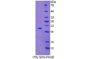 SDS-PAGE analysis of Rat Tenascin C Protein. (TNC Protéine)