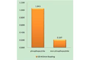 ELISA image for anti-Transforming Growth Factor, beta Receptor II (70/80kDa) (TGFBR2) (pSer225), (pSer250) antibody (ABIN1847404)