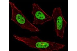 Fluorescent image of HeLa cells stained with SUMO2/3 antibody was diluted at 1:100 dilution. (SUMO2/3 anticorps  (AA 49-81))