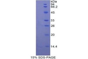 Cathepsin D (CTSD) ELISA Kit