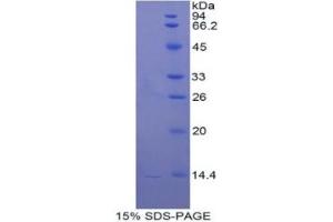 SDS-PAGE of Protein Standard from the Kit (Highly purified E. (Cathepsin D Kit ELISA)