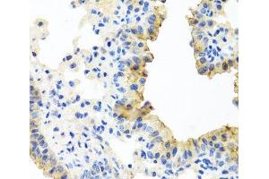 Immunohistochemistry of paraffin-embedded Mouse lung using FECH Polyclonal Antibody at dilution of 1:100 (40x lens). (FECH anticorps)
