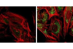 ICC/IF Image SQSTM1 antibody [N3C1], Internal detects SQSTM1 protein at autophagosome by immunofluorescent analysis.