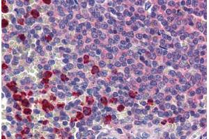 Human Spleen: Formalin-Fixed, Paraffin-Embedded (FFPE)