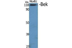 Western Blot (WB) analysis of specific cells using Bek Polyclonal Antibody. (FGFR2 anticorps  (Internal Region))