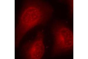 Immunofluorescence staining of methanol-fixed Hela cells using Phospho-HDAC8-S39 antibody. (HDAC8 anticorps  (pSer39))
