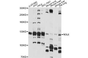 Western blot analysis of extracts of various cell lines, using NOL6 antibody (ABIN6290704) at 1:1000 dilution.