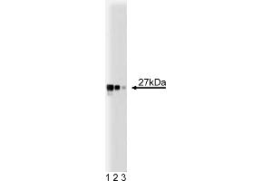 Western Blotting (WB) image for anti-Dynamin 1-Like (DNM1L) (AA 19-201) antibody (ABIN968652) (Dynamin 1-Like anticorps  (AA 19-201))