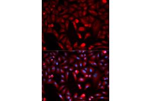 Immunofluorescence analysis of HeLa cell using PKM antibody. (PKM2 anticorps)
