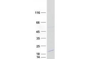 Validation with Western Blot