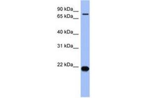 Image no. 1 for anti-Zinc Finger Protein 800 (ZNF800) (N-Term) antibody (ABIN6742935) (ZNF800 anticorps  (N-Term))