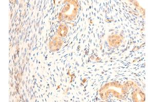ABIN6267220 at 1/100 staining rat uterine tissue sections by IHC-P.