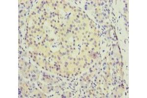 Immunohistochemistry of paraffin-embedded human pancreatic tissue using ABIN7157660 at dilution of 1:100 (KIFC3 anticorps  (AA 140-390))