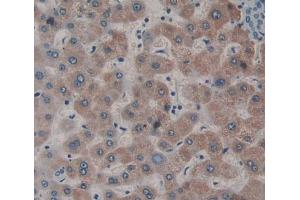 Used in DAB staining on fromalin fixed paraffin- embedded liver tissue