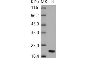 Non-Metastatic Cells 1, Protein (NM23A) Expressed in (NME1) protein (His tag)