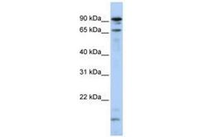 Image no. 1 for anti-Male-Specific Lethal 2 Homolog (MSL2) (N-Term) antibody (ABIN6740807)
