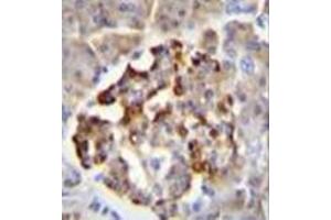 Immunohistochemistry analysis in formalin fixed and paraffin embedded human pancreas tissue reacted with GAD2 / GAD65 Antibody (Center) followed by peroxidase conjugation of the secondary antibody and DAB staining. (GAD65 anticorps  (Middle Region))