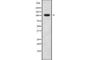 Western blot analysis of DSG3 using LOVO whole cell lysates (Desmoglein 3 anticorps  (C-Term))