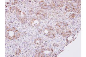 IHC-P Image Immunohistochemical analysis of paraffin-embedded NCIN87 xenograft , using RPL8, antibody at 1:100 dilution.