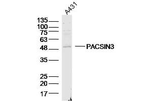 A431 lysates probed with PACSIN3 Polyclonal Antibody, Unconjugated  at 1:300 dilution and 4˚C overnight incubation.