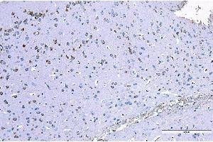 IHC analysis of RALBP1 using anti-RALBP1 antibody (ABIN7600800). (RALBP1 anticorps  (AA 239-506))