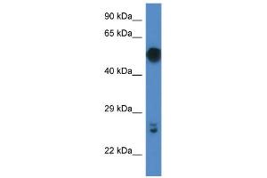 WB Suggested Anti-Gal3st4 Antibody   Titration: 1. (GAL3ST4 anticorps  (C-Term))