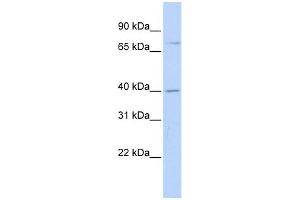 WB Suggested Anti-RHPN1 Antibody Titration: 0. (RHPN1 anticorps  (Middle Region))
