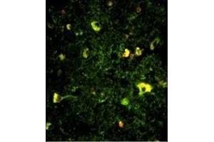 Immunofluorescence analysis of Rab5 Antibody (C-term) with paraffin-embedded human brain tissue.