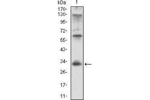 Western blot analysis using CD74 mouse mAb against Raji cell lysate.