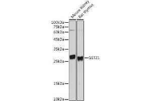 Western blot analysis of extracts of various cell lines, using GSTZ1 antibody (ABIN6132376, ABIN6141485, ABIN6141486 and ABIN6221727) at 1:500 dilution. (GSTZ1 anticorps  (AA 1-216))